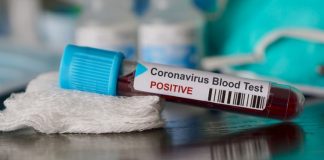 Datos actualizados del Coronavirus Coronavirus Manilva