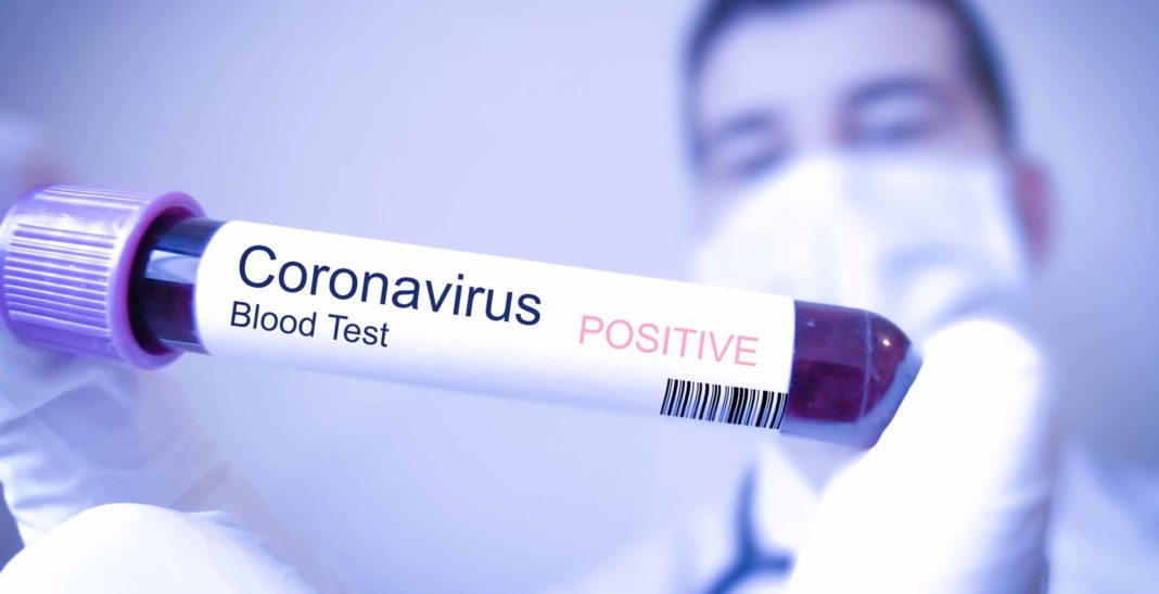 coronavirus-manilva-positivo