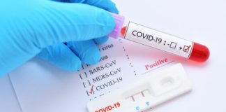 2 nuevos positivos por Coronavirus en Manilva coronavirus-positivo