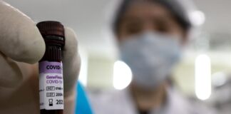 Despedimos agosto con 3 nuevos positivos covid manilva