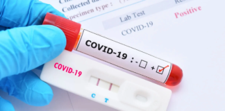 El SAS incorpora este lunes un nuevo test rápido test coronavirus