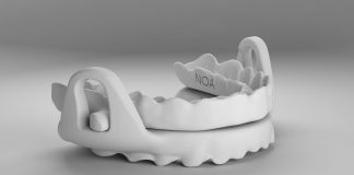¿Roncas o padeces apnea? En Sabinillas ya tienes una solución Clinica dental en Sabinillas