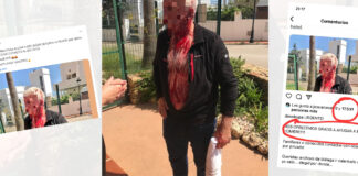 Brutal paliza de unos okupas al propietario de la vivienda